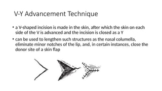 Principles In Plastic Surgery including skin grafting , flaps , wound ...