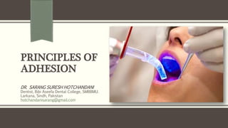 PRINCIPLES OF
ADHESION
DR. SARANG SURESH HOTCHANDANI
Dentist, Bibi Aseefa Dental College, SMBBMU.
Larkana, Sindh, Pakistan
hotchandanisarang@gmail.com
 