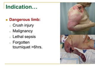 Indication… 
 Dangerous limb: 
o Crush injury 
o Malignancy 
o Lethal sepsis 
o Forgotten 
tourniquet >6hrs. 
 