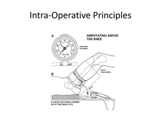 Intra-Operative Principles
 