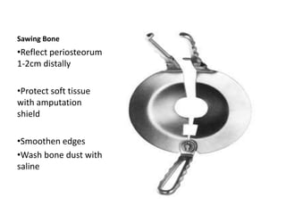 Sawing Bone
•Reflect periosteorum
1-2cm distally
•Protect soft tissue
with amputation
shield
•Smoothen edges
•Wash bone dust with
saline
 