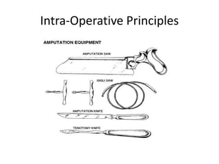 Intra-Operative Principles
 