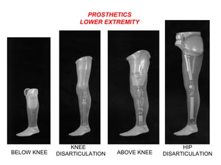 Types of Prosthesis
BELOW KNEE
KNEE
DISARTICULATION ABOVE KNEE
HIP
DISARTICULATION
PROSTHETICS
LOWER EXTREMITY
 