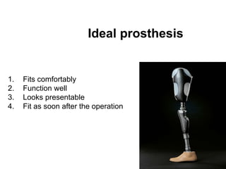 Ideal prosthesis
1. Fits comfortably
2. Function well
3. Looks presentable
4. Fit as soon after the operation
 