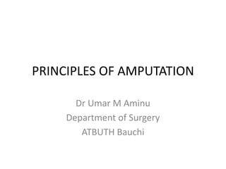 PRINCIPLES OF AMPUTATION
Dr Umar M Aminu
Department of Surgery
ATBUTH Bauchi
 