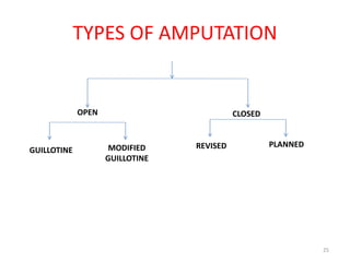 TYPES OF AMPUTATION
GUILLOTINE MODIFIED
GUILLOTINE
REVISED PLANNED
OPEN CLOSED
25
 