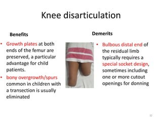Knee disarticulation
Benefits
• Growth plates at both
ends of the femur are
preserved, a particular
advantage for child
patients.
• bony overgrowth/spurs
common in children with
a transection is usually
eliminated
Demerits
• Bulbous distal end of
the residual limb
typically requires a
special socket design,
sometimes including
one or more cutout
openings for donning
32
 