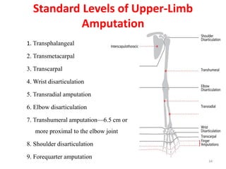 Standard Levels of Upper-Limb
Amputation
1. Transphalangeal
2. Transmetacarpal
3. Transcarpal
4. Wrist disarticulation
5. Transradial amputation
6. Elbow disarticulation
7. Transhumeral amputation—6.5 cm or
more proximal to the elbow joint
8. Shoulder disarticulation
9. Forequarter amputation
34
 