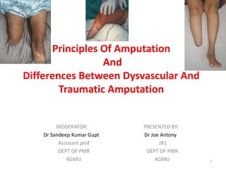 Principles Of Amputation
And
Differences Between Dysvascular And
Traumatic Amputation
MODERATOR:
Dr Sandeep Kumar Gupt
Assistant prof
DEPT OF PMR
KGMU
PRESENTED BY:
Dr Joe Antony
JR1
DEPT OF PMR
KGMU 1
 