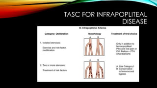 Peripheral Angioplasty / Endovascular Management of PVD - Principles | PPTX