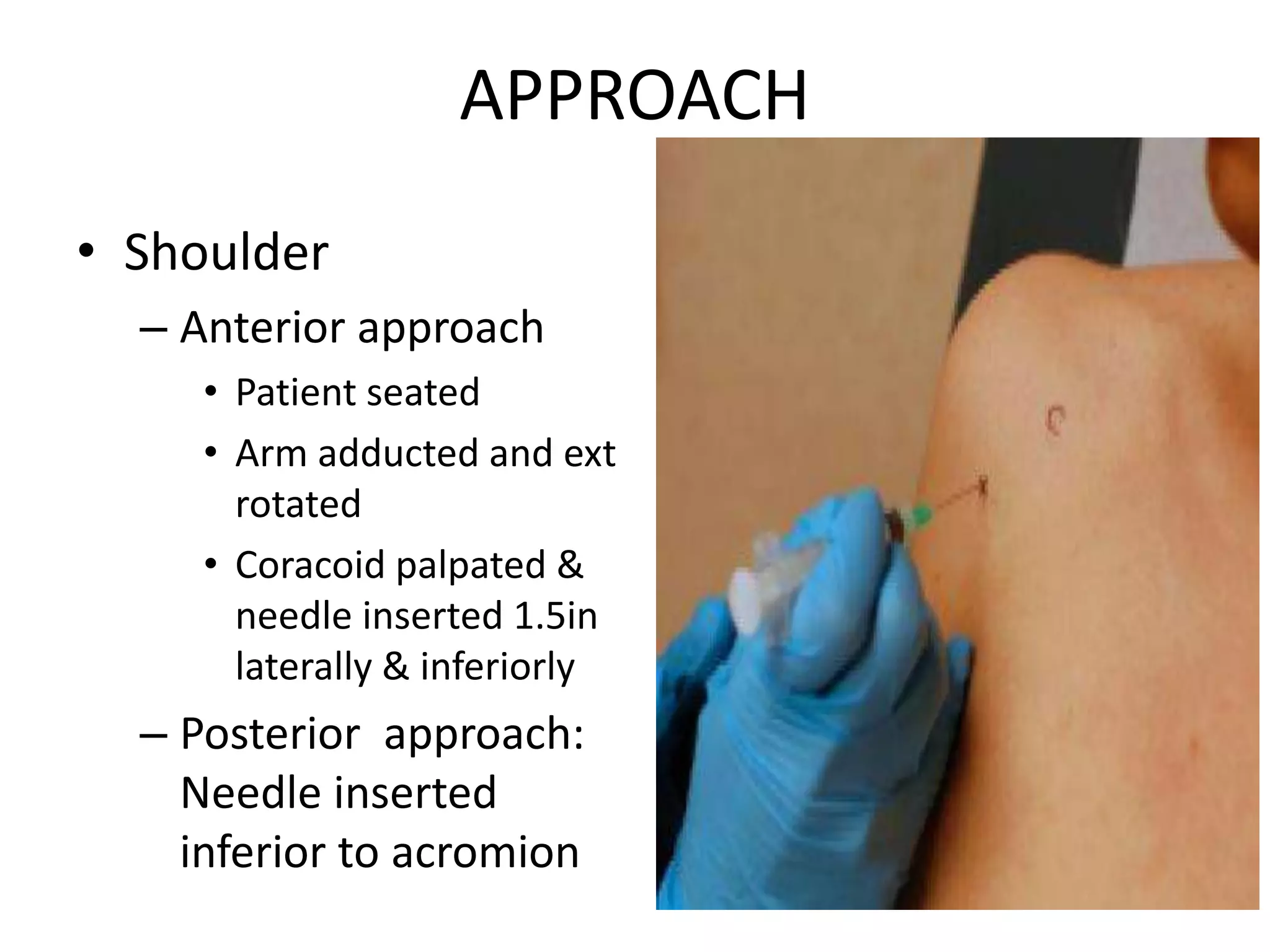 APPROACH
• Shoulder
– Anterior approach
• Patient seated
• Arm adducted and ext
rotated
• Coracoid palpated &
needle inserted 1.5in
laterally & inferiorly
– Posterior approach:
Needle inserted
inferior to acromion
 