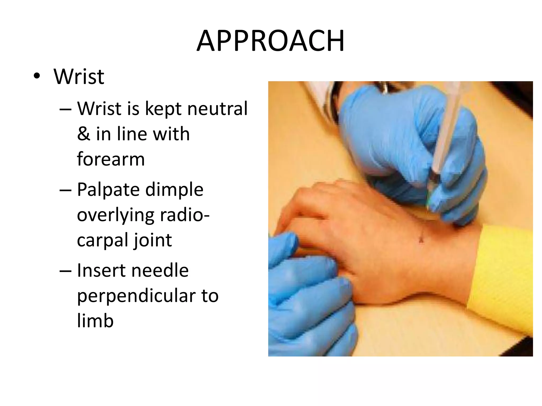 APPROACH
• Wrist
– Wrist is kept neutral
& in line with
forearm
– Palpate dimple
overlying radio-
carpal joint
– Insert needle
perpendicular to
limb
 