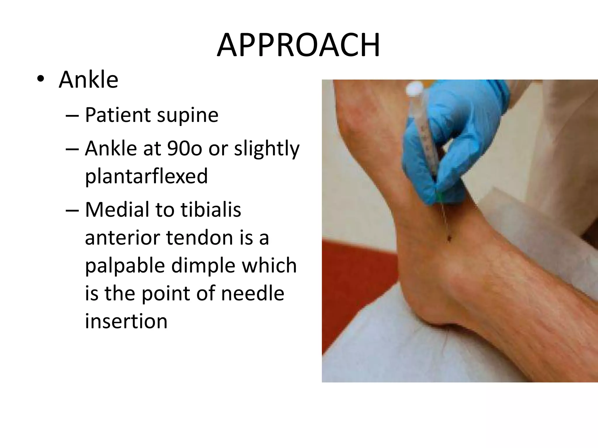 APPROACH
• Ankle
– Patient supine
– Ankle at 90o or slightly
plantarflexed
– Medial to tibialis
anterior tendon is a
palpable dimple which
is the point of needle
insertion
 