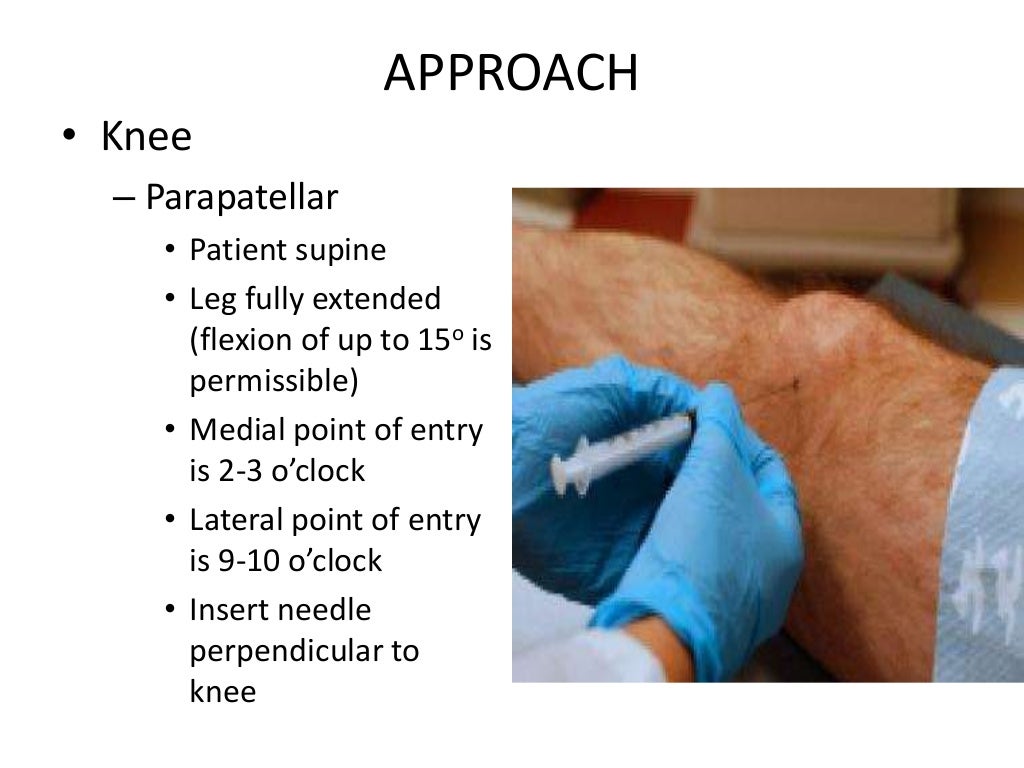 Principles of arthrotomy & arthrocentesis