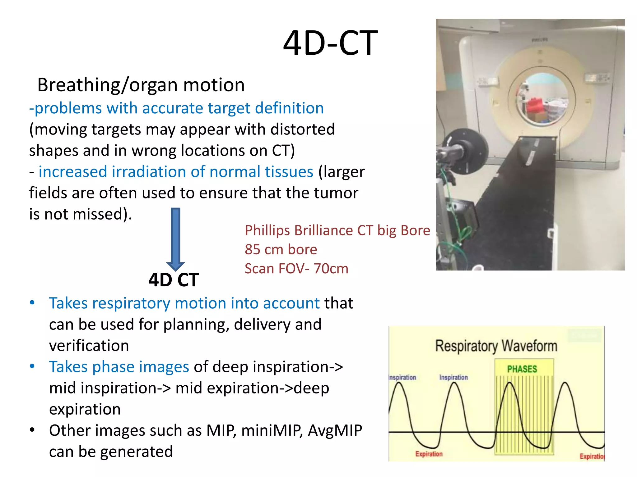 4D-CT
Breathing/organ motion
-problems with accurate target definition
(moving targets may appear with distorted
shapes and in wrong locations on CT)
- increased irradiation of normal tissues (larger
fields are often used to ensure that the tumor
is not missed).
4D CT
• Takes respiratory motion into account that
can be used for planning, delivery and
verification
• Takes phase images of deep inspiration->
mid inspiration-> mid expiration->deep
expiration
• Other images such as MIP, miniMIP, AvgMIP
can be generated
Phillips Brilliance CT big Bore
85 cm bore
Scan FOV- 70cm
 