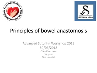 Principles of bowel anastomosis
Advanced Suturing Workshop 2018
30/06/2018
Chea Chan Hooi
Surgeon
Sibu Hospital
 