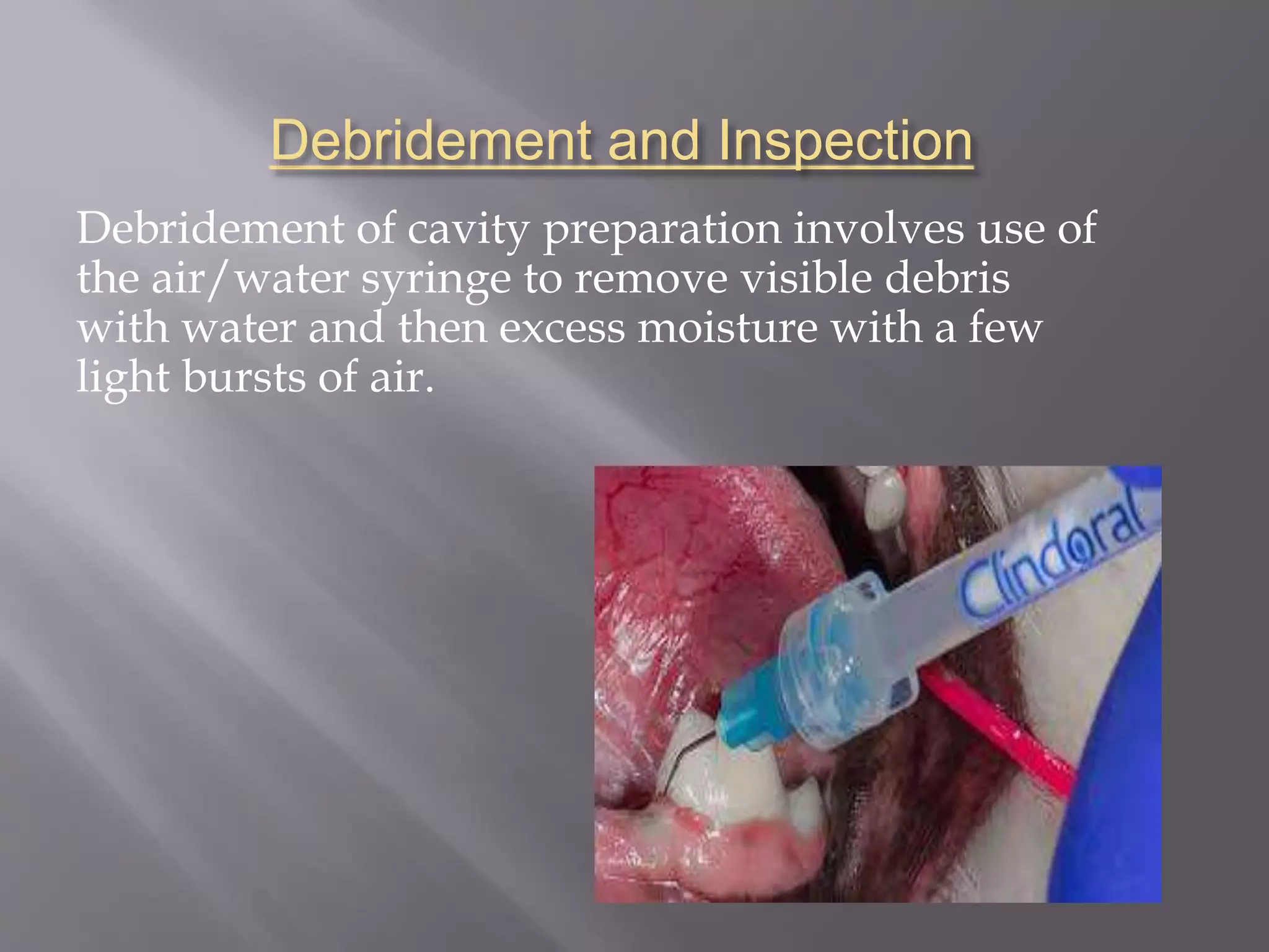Principles of cavity preparation | PPTX