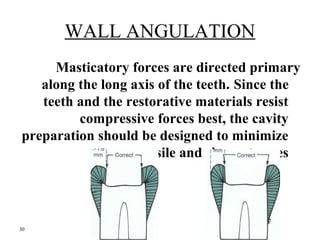 WALL ANGULATION 
Masticatory forces are directed primary 
along the long axis of the teeth. Since the 
teeth and the resto...