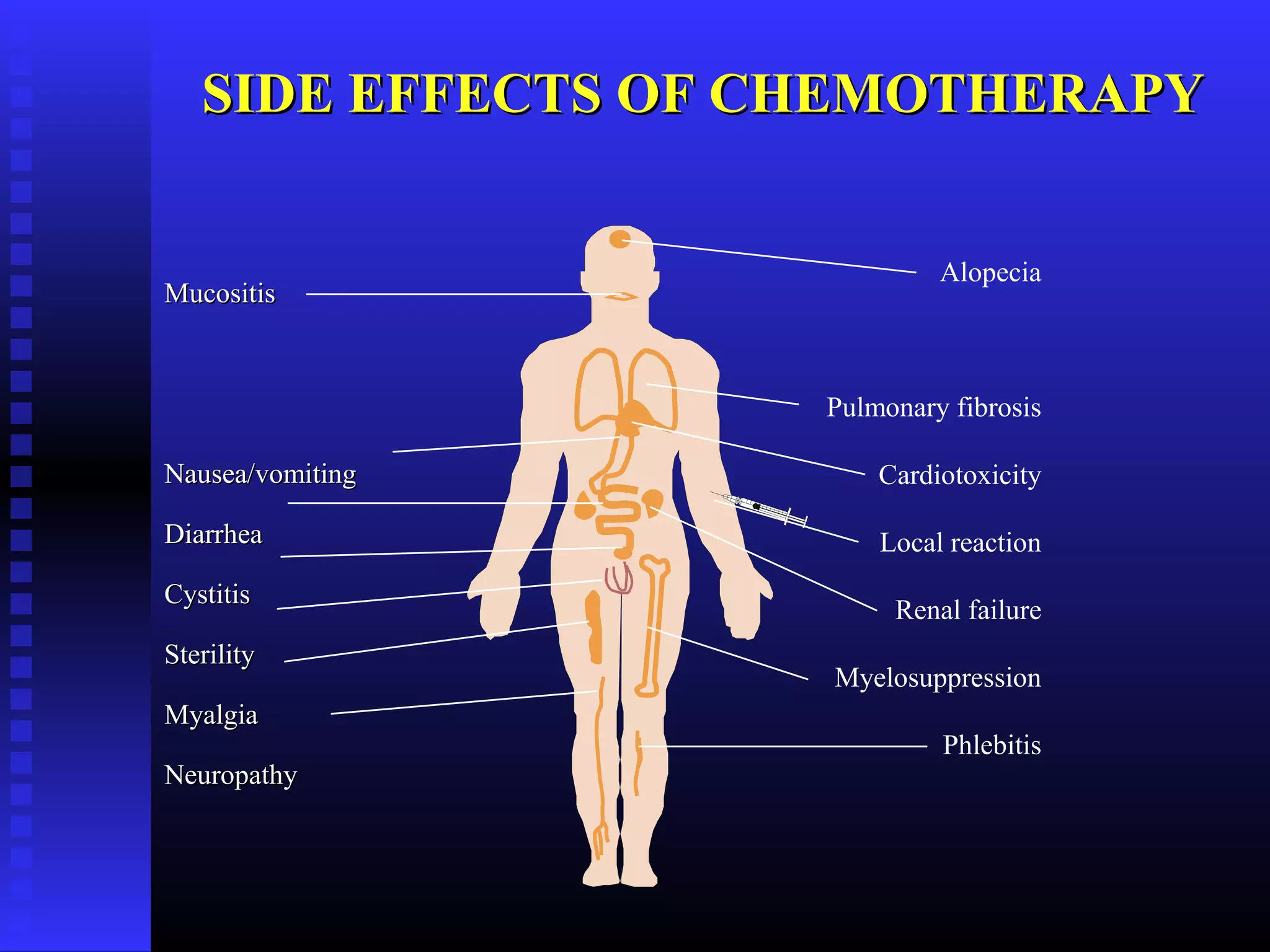 MucositisMucositis
Nausea/vomitingNausea/vomiting
DiarrheaDiarrhea
CystitisCystitis
SterilitySterility
MyalgiaMyalgia
NeuropathyNeuropathy
Alopecia
Pulmonary fibrosis
Cardiotoxicity
Local reaction
Renal failure
Myelosuppression
Phlebitis
SIDE EFFECTS OF CHEMOTHERAPYSIDE EFFECTS OF CHEMOTHERAPY
 