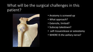 1principles of Chronic dislocations.pptx