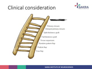 SAKRA INSTITUTE OF NEUROSCIENCES
Clinical consideration
 