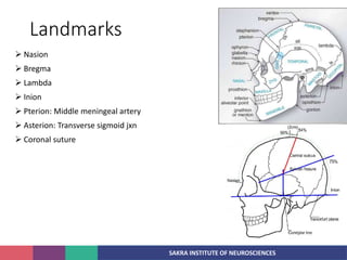 SAKRA INSTITUTE OF NEUROSCIENCES
Landmarks
 Nasion
 Bregma
 Lambda
 Inion
 Pterion: Middle meningeal artery
 Asterion: Transverse sigmoid jxn
 Coronal suture
 