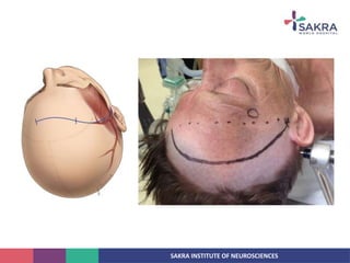 SAKRA INSTITUTE OF NEUROSCIENCES
 