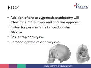 SAKRA INSTITUTE OF NEUROSCIENCES
FTOZ
 