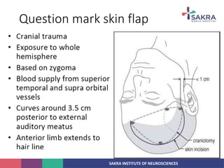 SAKRA INSTITUTE OF NEUROSCIENCES
Question mark skin flap
 