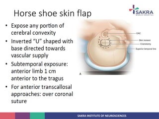 SAKRA INSTITUTE OF NEUROSCIENCES
Horse shoe skin flap
 