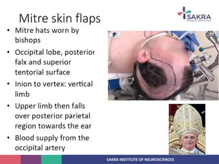 SAKRA INSTITUTE OF NEUROSCIENCES
Mitre skin flaps
 