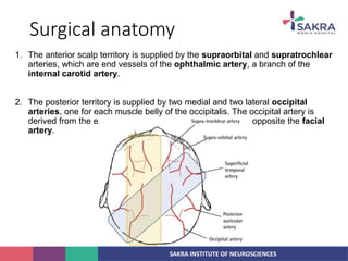 SAKRA INSTITUTE OF NEUROSCIENCES
Surgical anatomy
1. The anterior scalp territory is supplied by the supraorbital and supratrochlear
arteries, which are end vessels of the ophthalmic artery, a branch of the
internal carotid artery.
2. The posterior territory is supplied by two medial and two lateral occipital
arteries, one for each muscle belly of the occipitalis. The occipital artery is
derived from the external carotid artery as it branches just opposite the facial
artery.
 