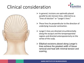 SAKRA INSTITUTE OF NEUROSCIENCES
Clinical consideration
 In general, incisions are optimally placed
parallel to skin tension lines, referred to as
“lines of election” or “Langer’s lines.”
 These lines lie perpendicular to the direction of
underlying muscular contraction.
 Langer’s lines are directed circumferentially
along the occiput and the temporoparietal
regions and directed anteroposteriorly on the
vertex of the scalp.
 Elliptical excisions placed along Langer’s
lines achieve the greatest width of tissue
removal and heal with minimal tension and
scarring.
 