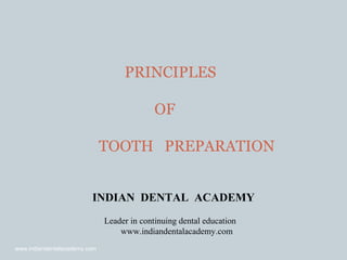 PRINCIPLES
OF
TOOTH PREPARATION
INDIAN DENTAL ACADEMY
Leader in continuing dental education
www.indiandentalacademy.com
www.indiandentalacademy.com
 
