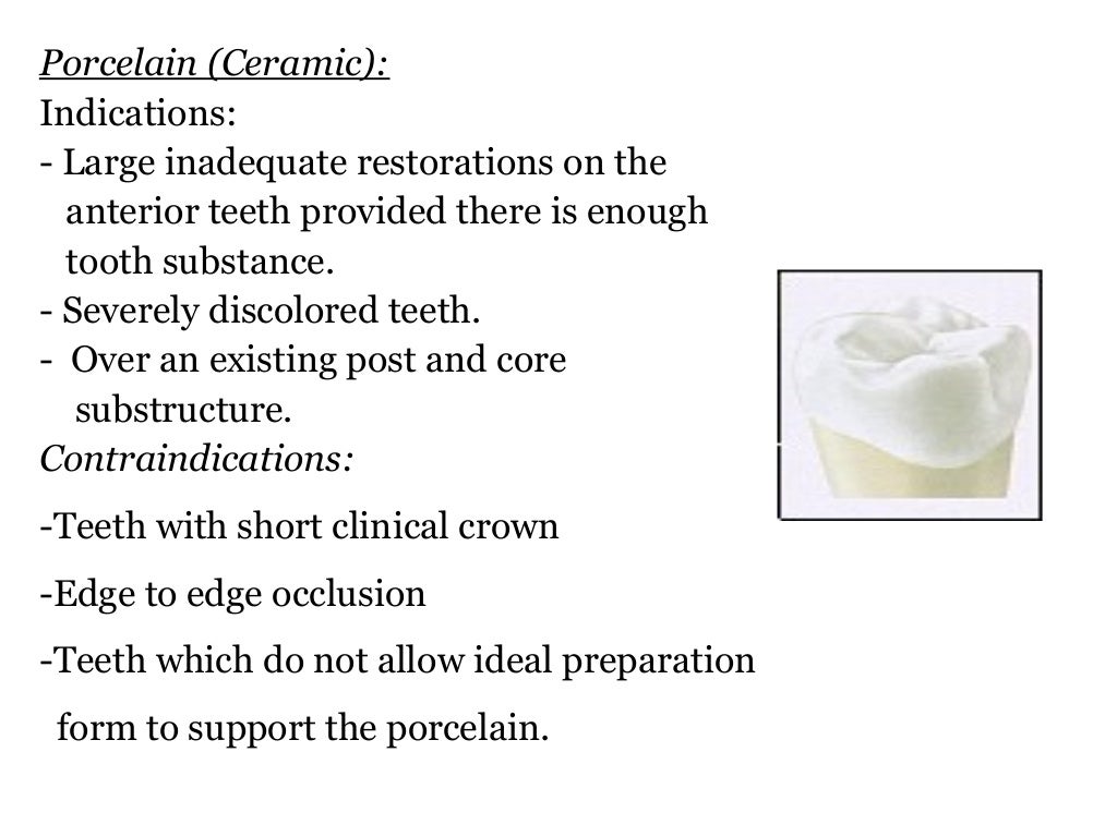 Principles of crown preparation/ orthodontic seminars