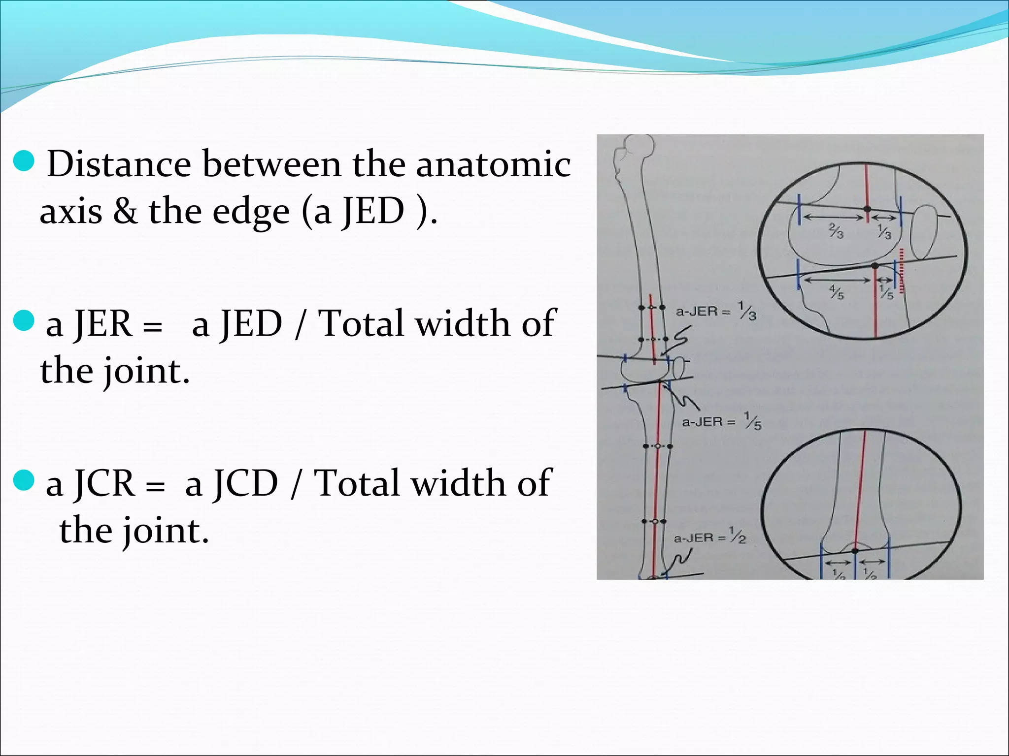 Distance between the anatomic
axis & the edge (a JED ).
a JER = a JED / Total width of
the joint.
a JCR = a JCD / Total width of
the joint.
 
