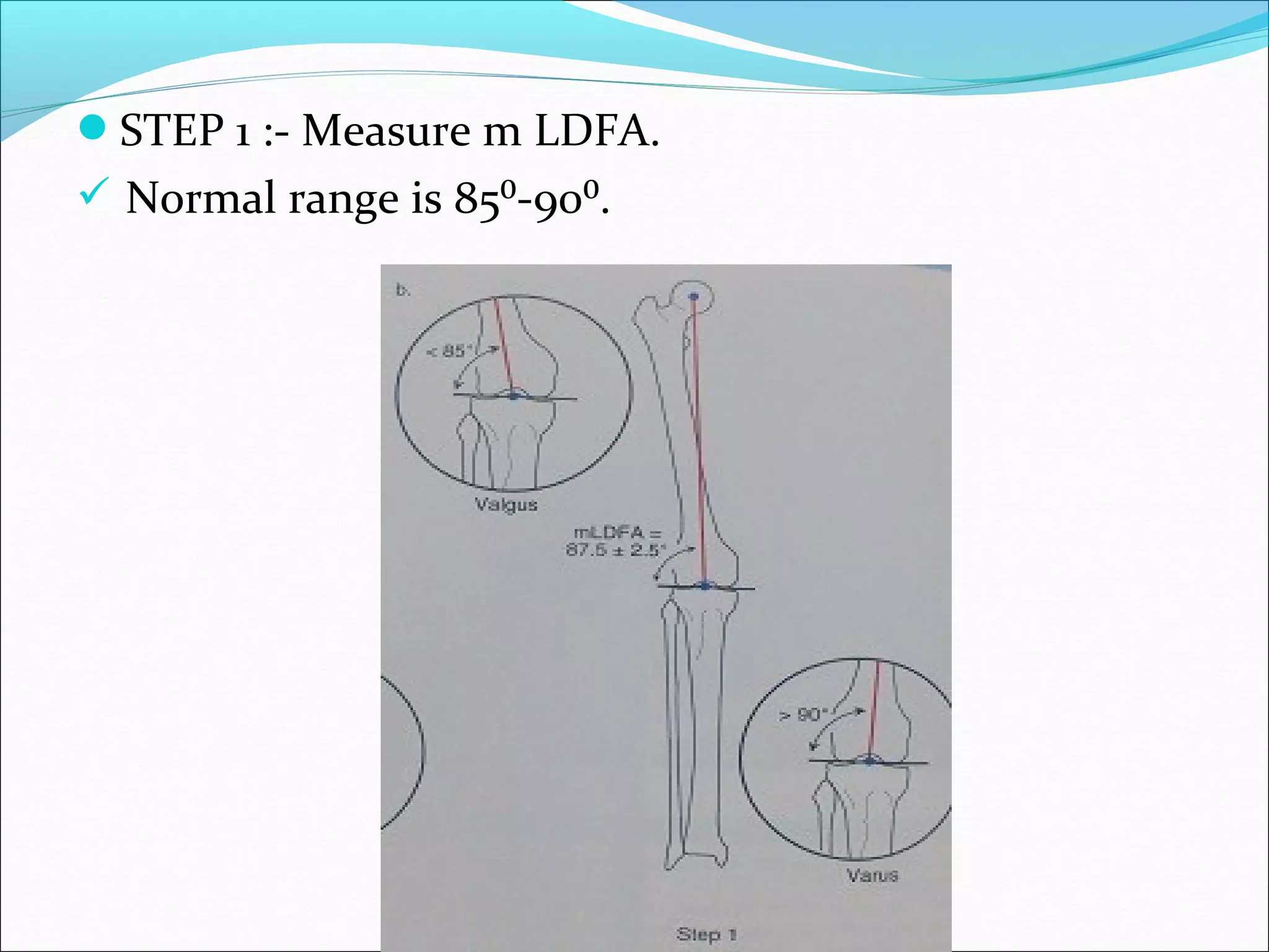 STEP 1 :- Measure m LDFA.
 Normal range is 85⁰-90⁰.
 