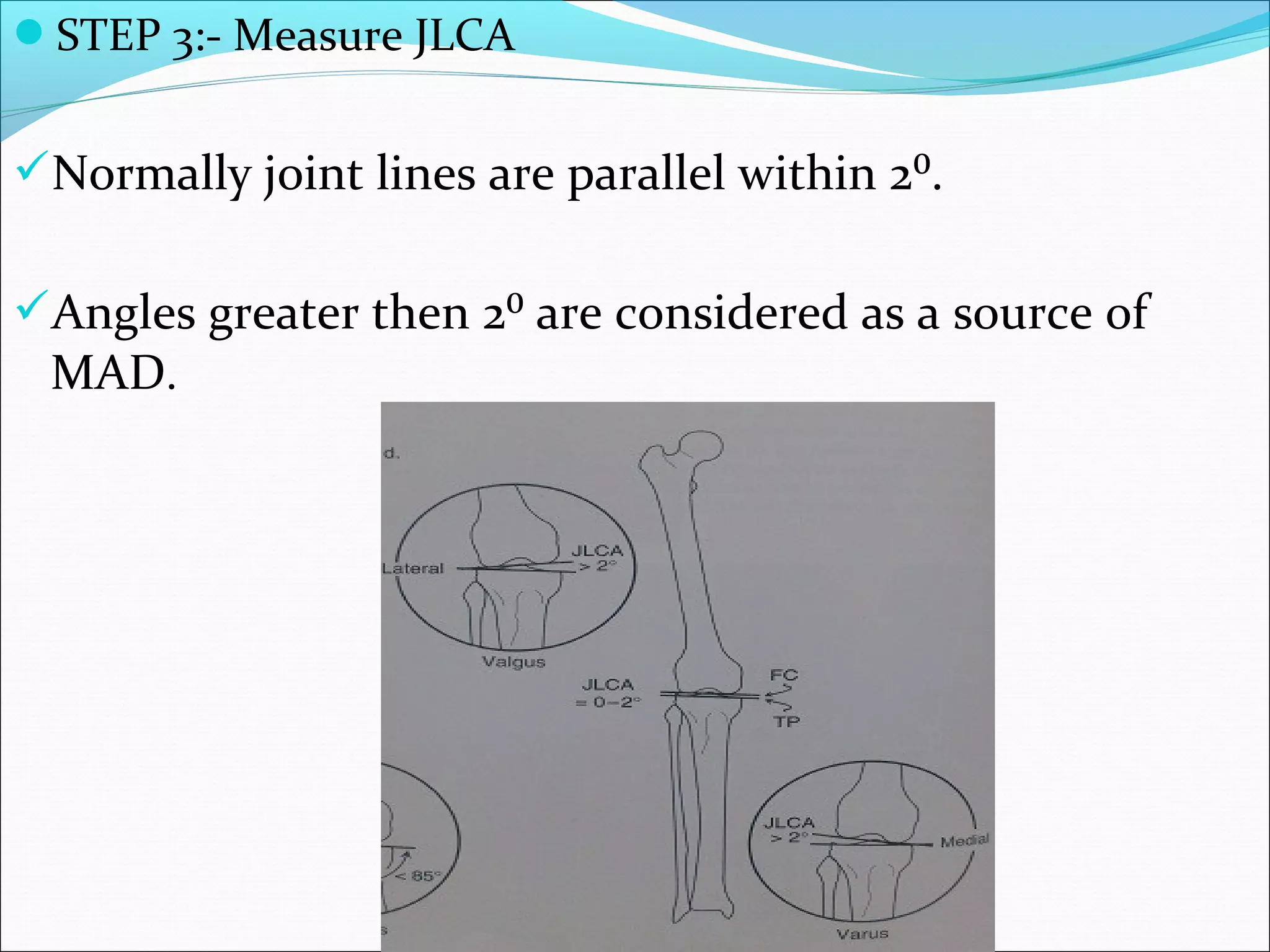 STEP 3:- Measure JLCA
Normally joint lines are parallel within 2⁰.
Angles greater then 2⁰ are considered as a source of
MAD.
 