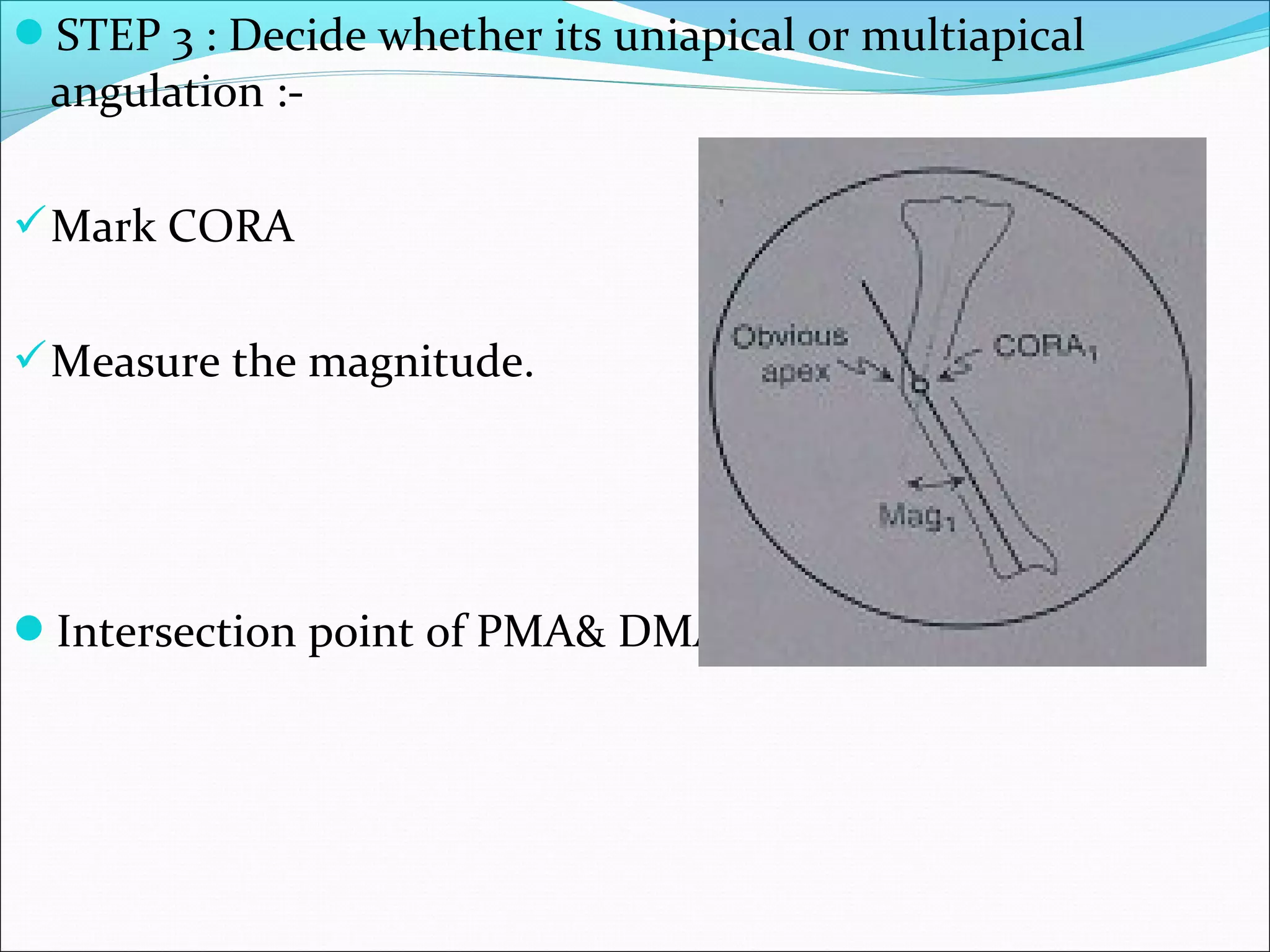 STEP 3 : Decide whether its uniapical or multiapical
angulation :-
Mark CORA
Measure the magnitude.
Intersection point of PMA& DMA is CORA.
 