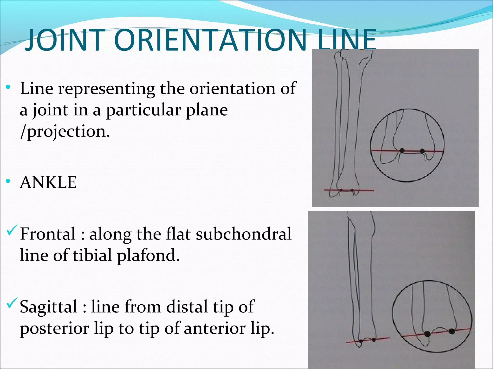 JOINT ORIENTATION LINE
• Line representing the orientation of
a joint in a particular plane
/projection.
• ANKLE
Frontal : along the flat subchondral
line of tibial plafond.
Sagittal : line from distal tip of
posterior lip to tip of anterior lip.
 