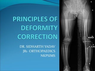 DR. SIDHARTH YADAV
JR1 ORTHOPAEDICS
NKPSIMS
 