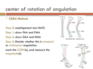 principlesofdeformitycorrection-170315094315.pptx