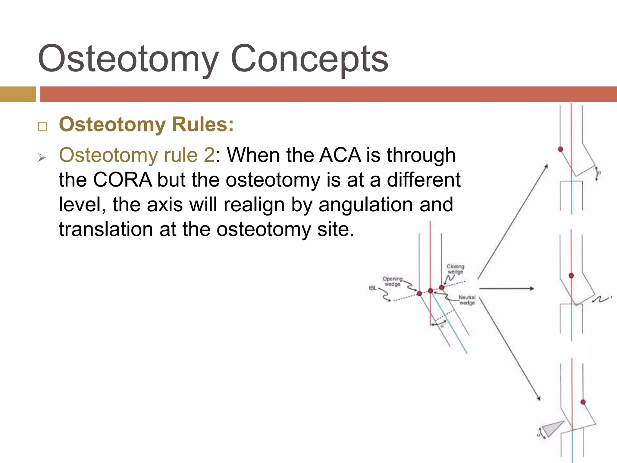 Principles of deformity correction | PPTX