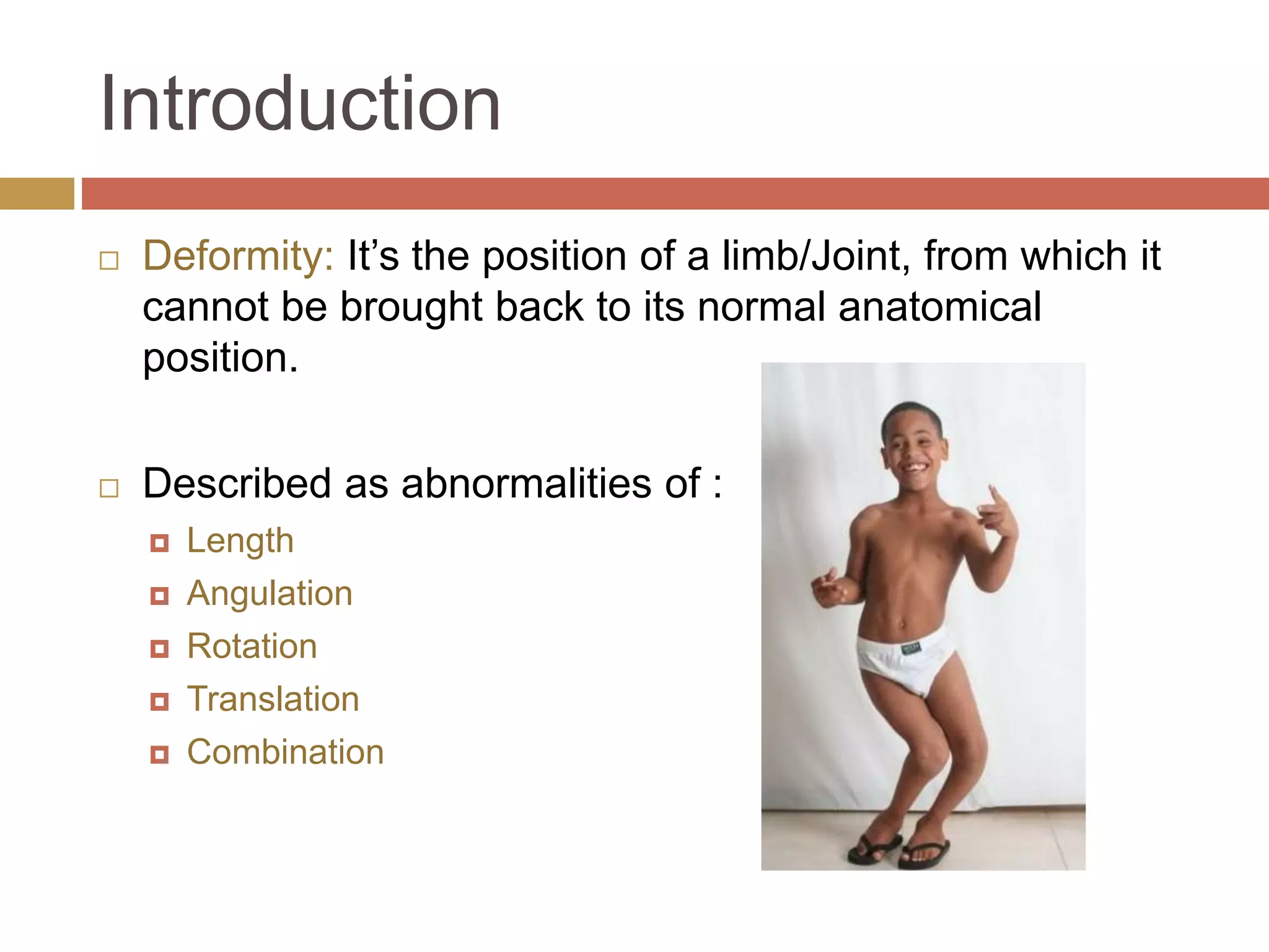 Deformity Example Principles of deformity correction | PPTX