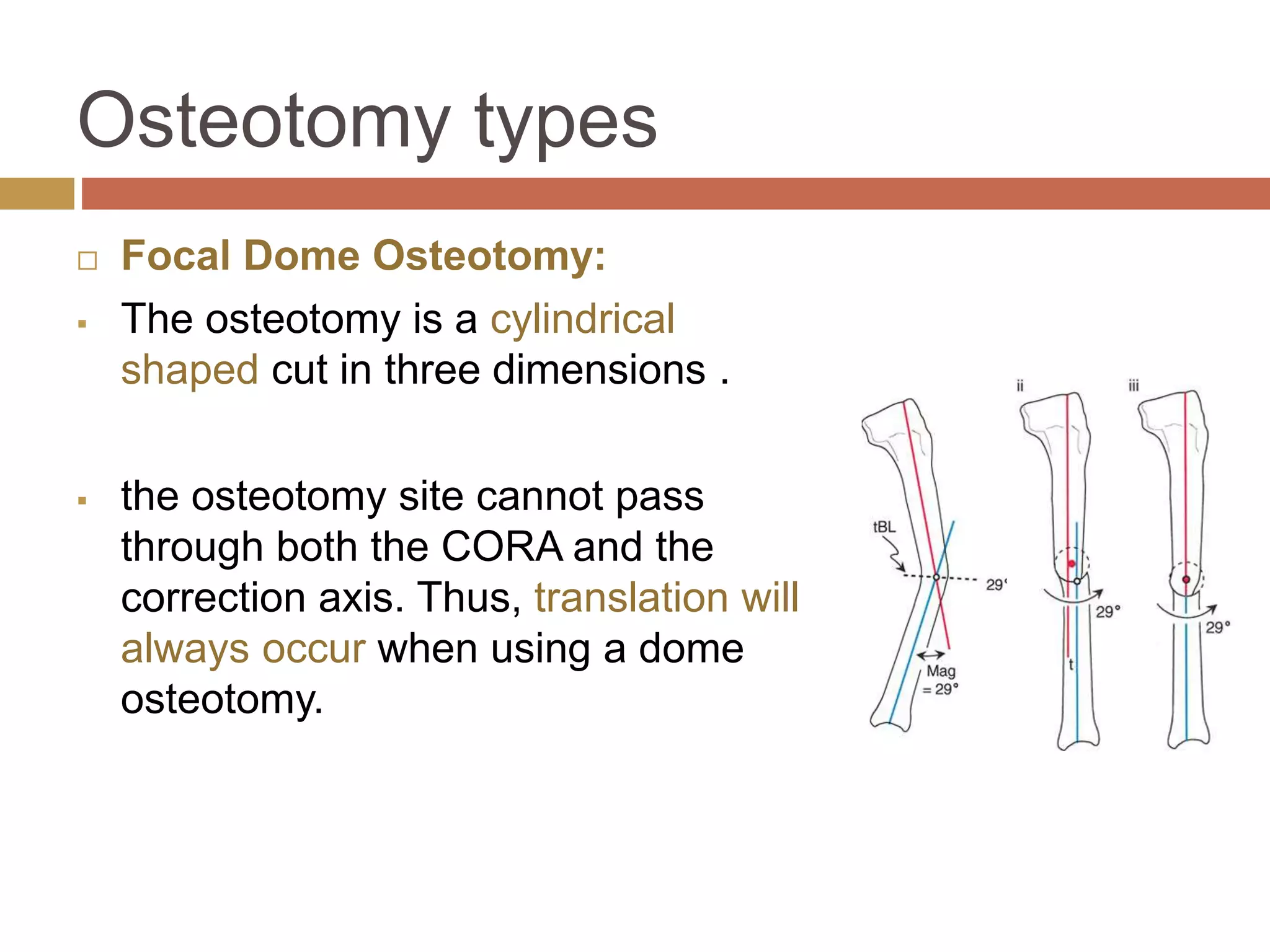 語学・辞書・学習参考書 principles of deformity correction Tibial Uniapical Deformity - YouTube