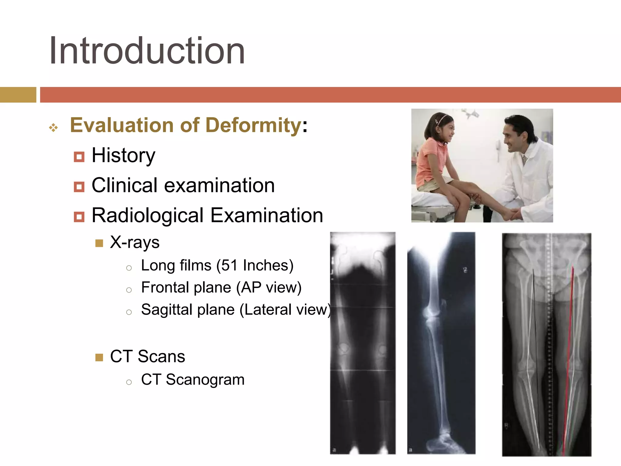 Principles of deformity correction | PPTX