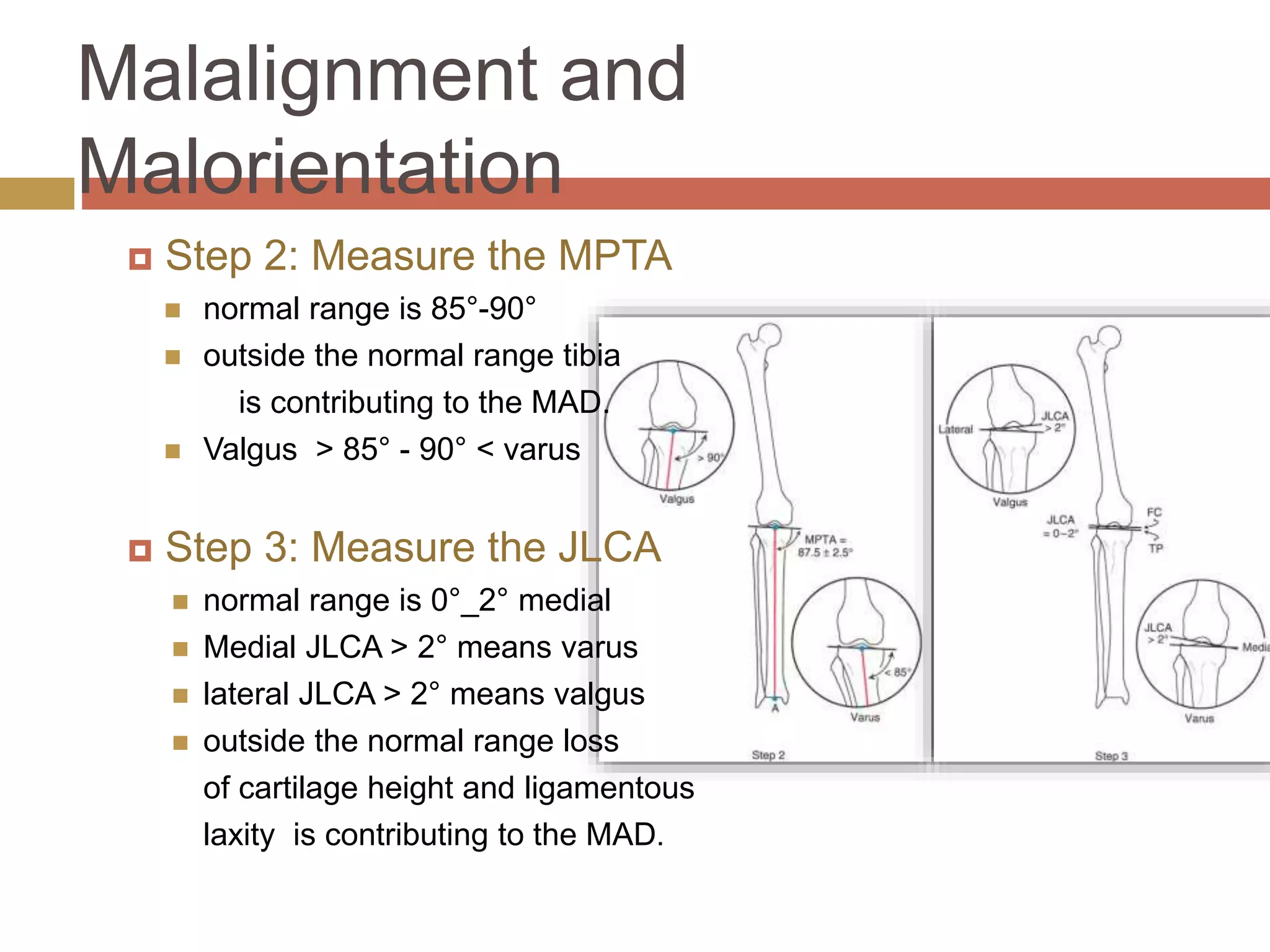 Principles of deformity correction | PPTX | Death, Injury