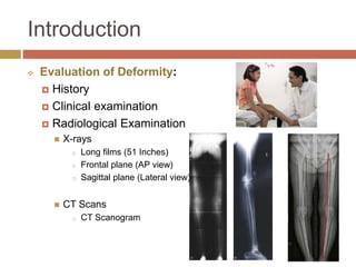 語学・辞書・学習参考書 principles of deformity correction Principles of Deformity Correction: Exercise Workbook