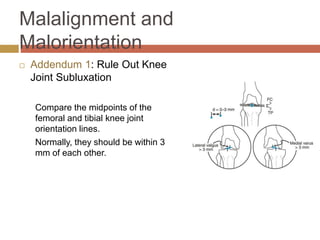 Principles of deformity correction | PPTX | Death, Injury