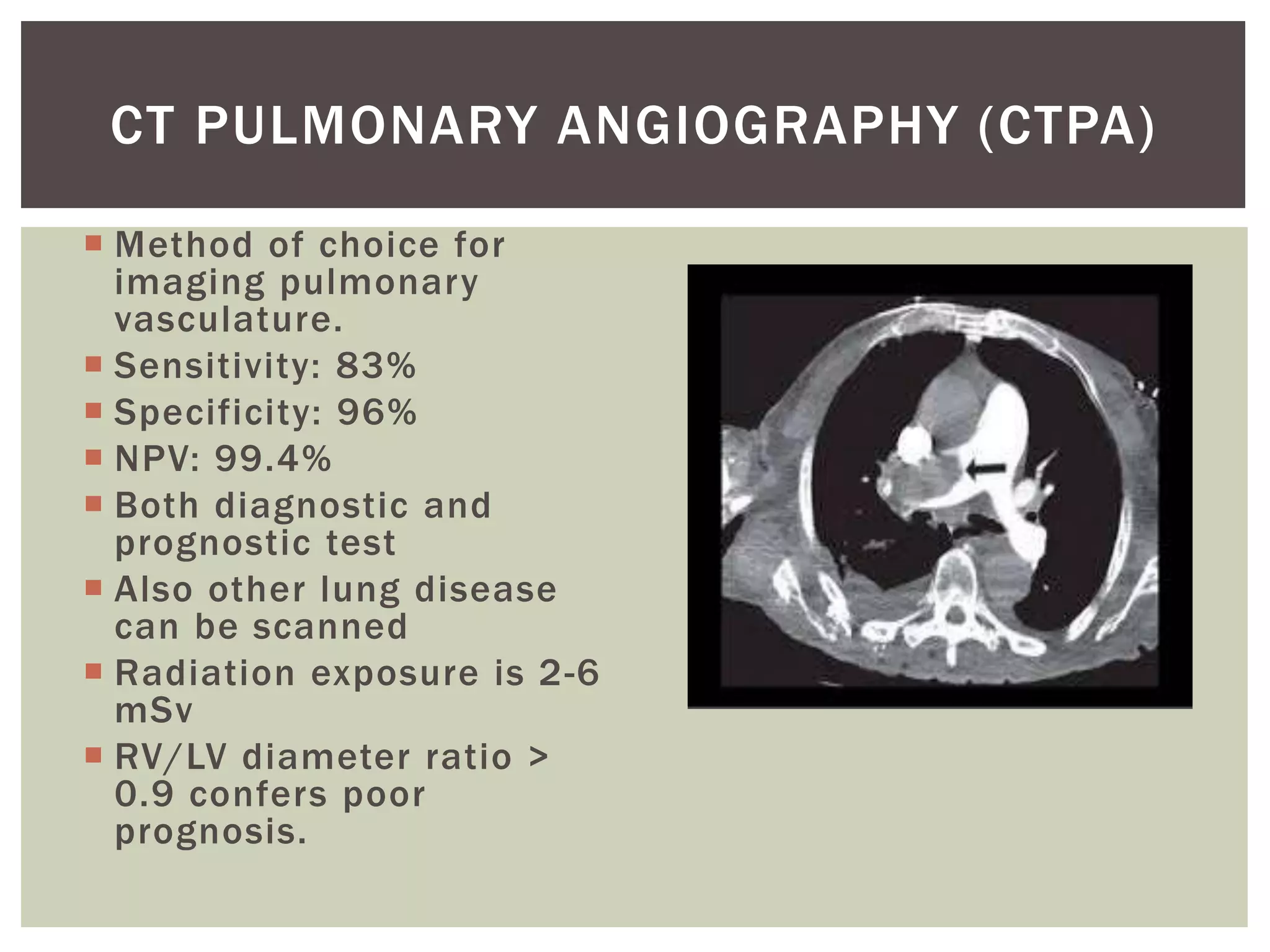 Principles of diagnosis & management of acute pulmonary | PPTX | Heart ...